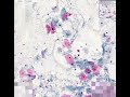 Histopathology Cervix--High grade squamous intraepithelial l