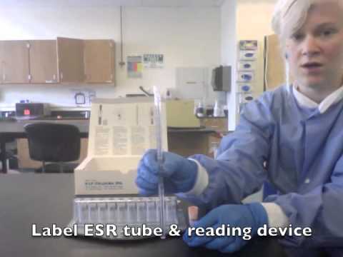 how to perform esr blood test