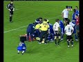 http://www.videosdesoyder.es Ruben de la red se desmaya en el partido del Real Irun-Real Madrid