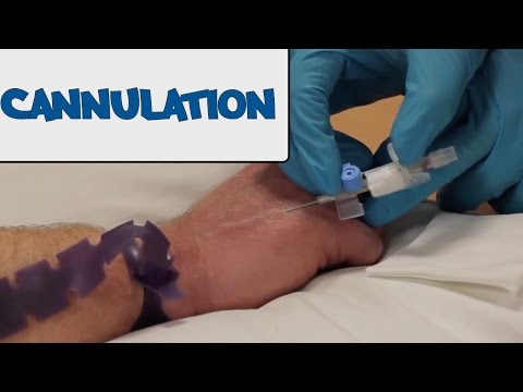 how to perform iv insertion