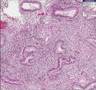 Histopathology Uterus, endometrium--Secretory endometrium