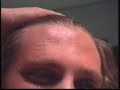 See Video