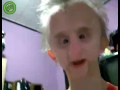 greatest rapper of all time MC progeria