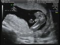 Ultrasound Week 15 Video