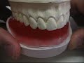 Como recortar e deixar o modelo em articulador padrao