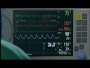 Thrombocheck