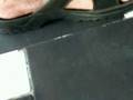 Older Man with Long Toenails