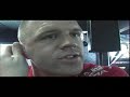 MMA Fighters Talk Cauliflower ears aka perichondrial hematoma