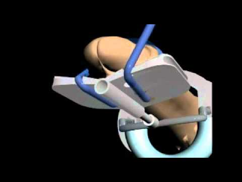 الزب الطويل - The Most revolutionary Penis Extender Yet Invented. Discreet and safe.