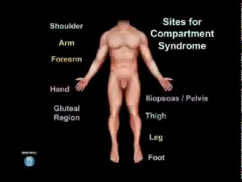 how to assess neurovascular status