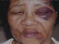 62-year-old says deputies beat her