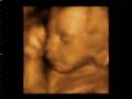 videos de Sami - Dimples!