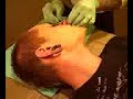 Miznatch Gets His Nose Dermal Punched Miznatch Gets His Nose Dermal Punched