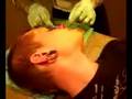 videos de Miznatch Gets His Nose Dermal Punched
