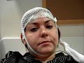 Epilepsy Video EEG by The Holden Foundation Epilepsy Video EEG by The Holden Foundation