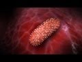 Bubonic Plague - Monsters Inside Me Ep6 - YouTube