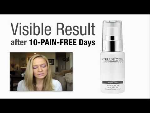 how to eliminate sebum