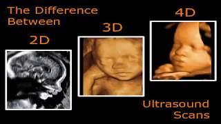 2D 3D 4D Ultrason Cihazının Farkı