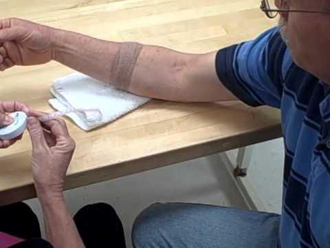 how to assess for edema