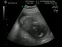 pongerts - my baby
