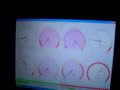 Distributorless Bug Test