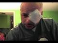 Mr Teste Needs a Doctor!!