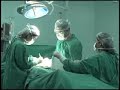 Transplante de fígado Transplante de fígado