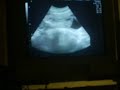 Mi bebita Isidora antonia
