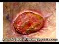 Body Piercing Training For Different Types of Body Piercings