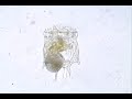 Rotifer , Plationus  patulus .wmv