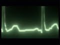 2008.12.08 ???????????Teaser