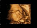 videos de Benjamin Knudson 2