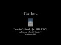 Lap Sleeve Gastrectomy in HD Narrated by Dr  Smith