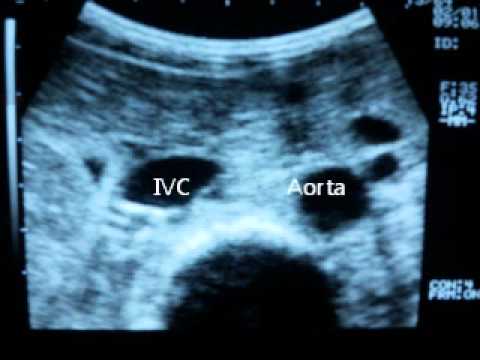 how to assess volume status