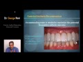 002-07 Anterior Implant Restoration: Advanced Concerns PREVIEW