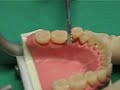 Modified Root Elevator acc. to Dentist Beck