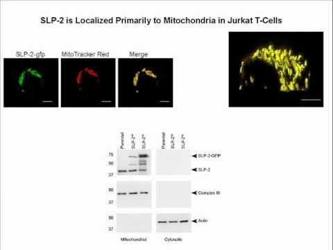 Linking cardiolipin remodeling to mitochondrial beta-oxidation