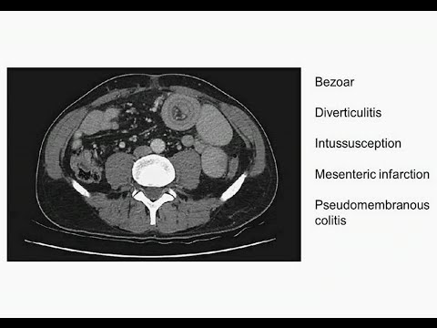 how to isolate intestinal epithelial cells