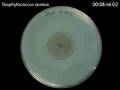 videos de Staphylococcus aureus - Zonex