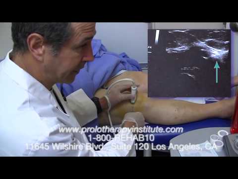 how to isolate bone marrow stem cells