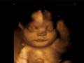 Babypatriotaction's 4D ultrasound pictures