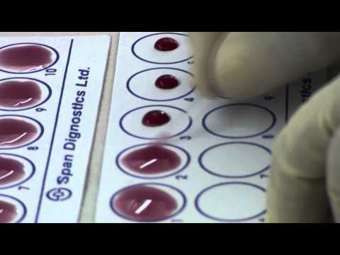 how to perform typhoid test