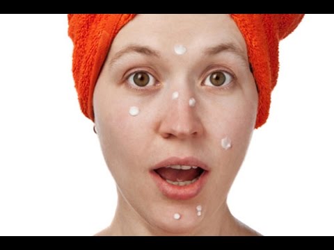 nivea cream for acne scars