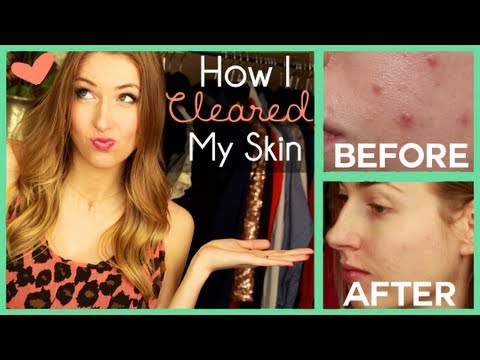 how to clear up skin fast