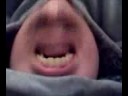 Chin Face (French Face #2)