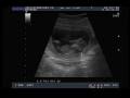 videos de Zoon i.u. -12