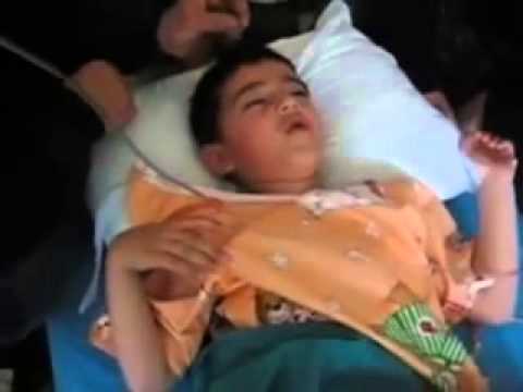 Narkoz Verilen Çocuğun Komik Halleri videosu