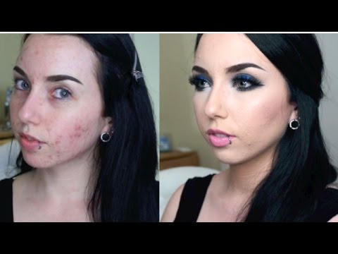 ACNE COVERAGE + Royal Blue Smokey Eye | Get Ready With Me