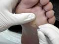 videos de EDEPACH