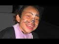 Areah & Rett Syndrome Pervasive Developmental Disorders